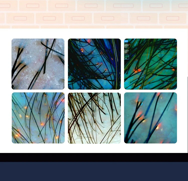 Al Skin And Hair Analyzer high quality